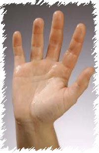 不用手术就能消除手掌出汗